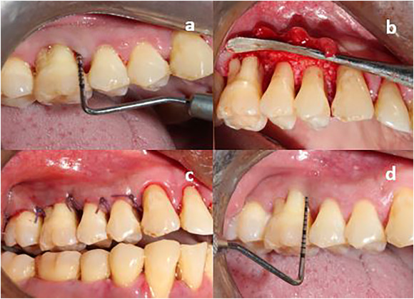 32 Strong Dental